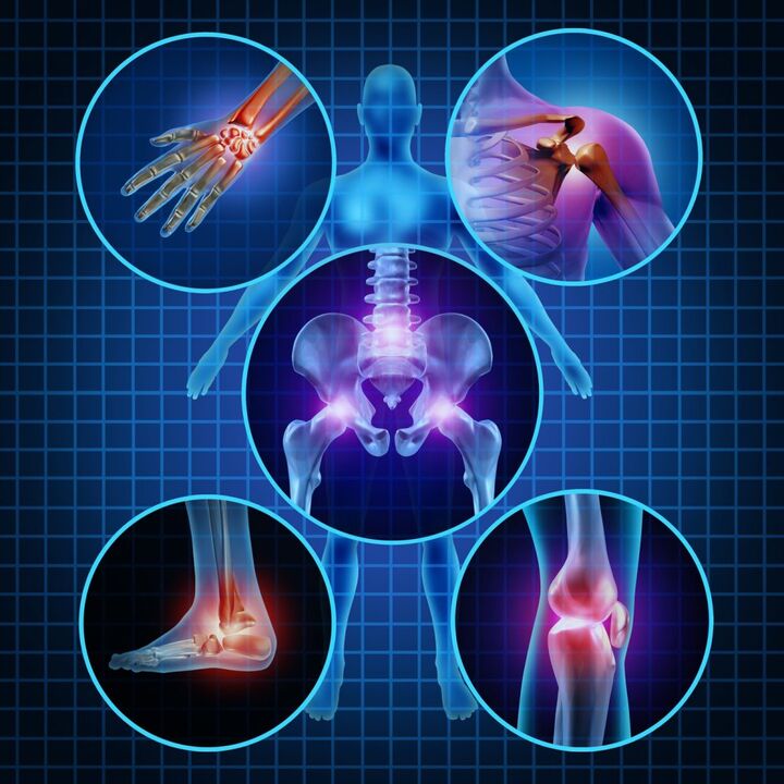 joints affected by arthrosis