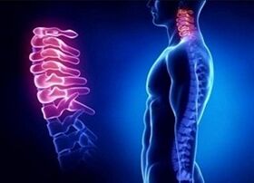 Causes -Security Development of cervical osteochondrosis