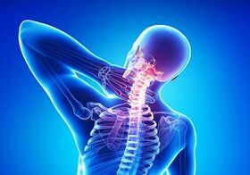 Possible complications with an osteochondrosis intersection