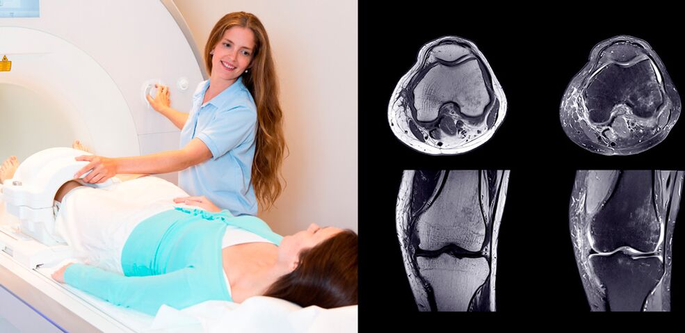 Joint diagnosis of the knee
