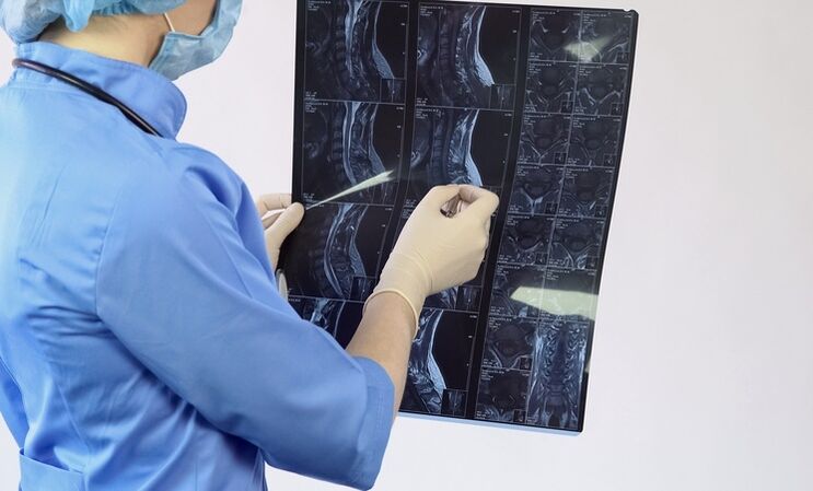 Diagnosis of cervical osteochondrosis is made based on MRI studies